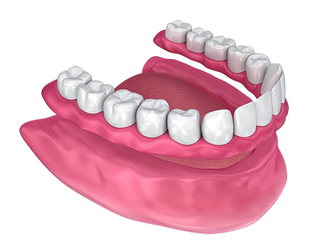 Full dentures - Plates
