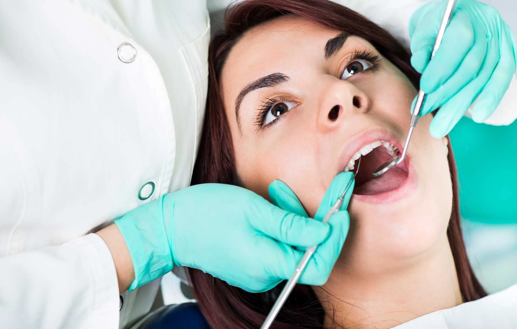 Dental Filling Turned Black – What Does it Mean?
