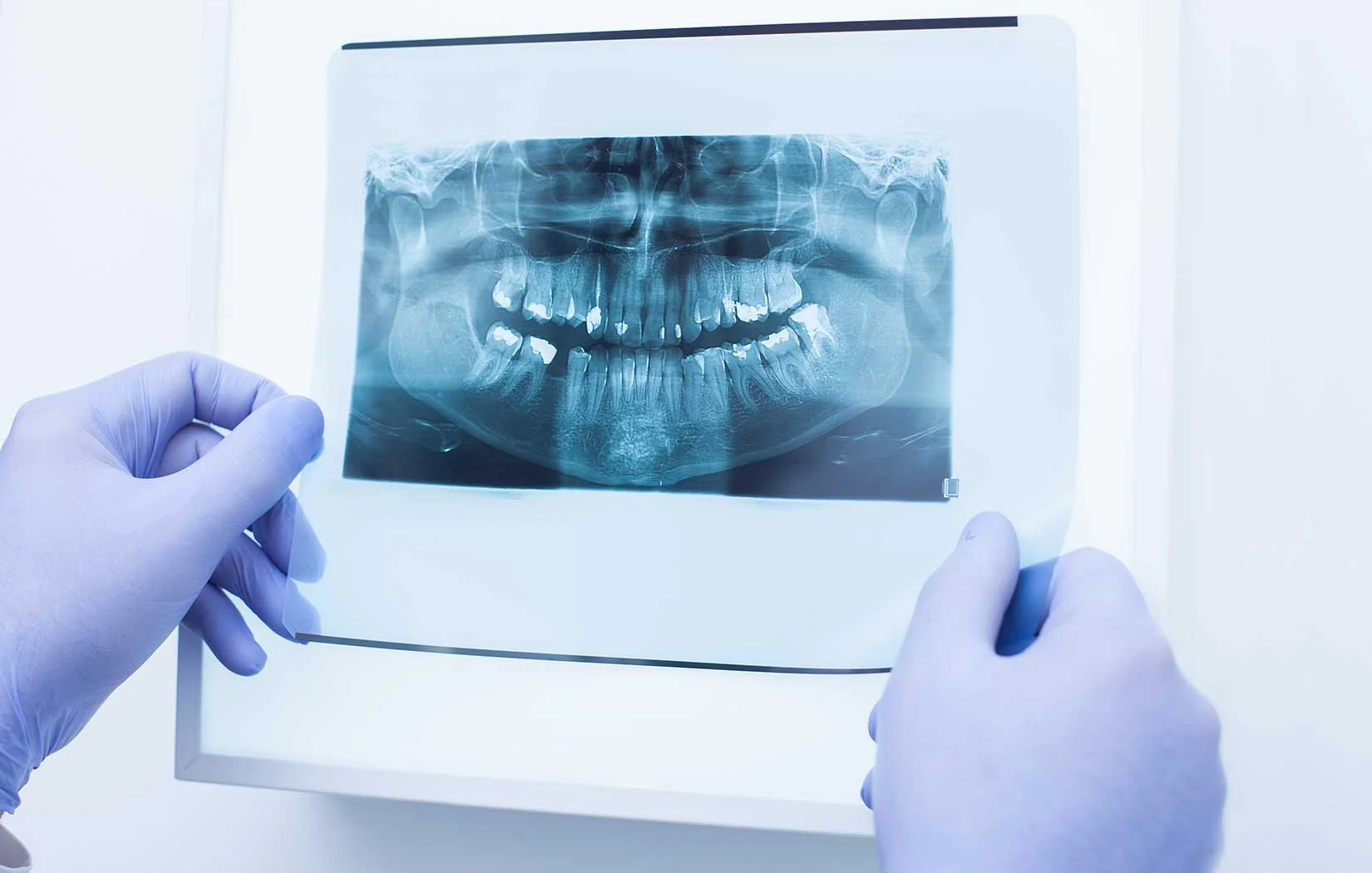 Dentist diagnosing oral cancer at Brentwood, Los Angeles, CA