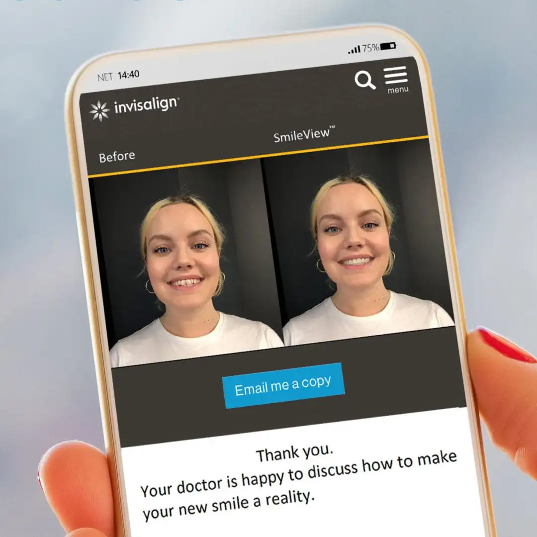 Invisalign® Before and after app
